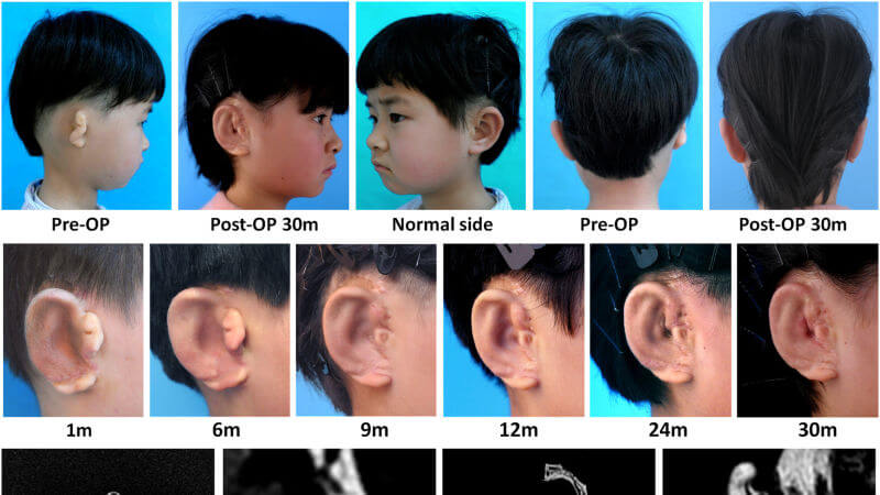 ears