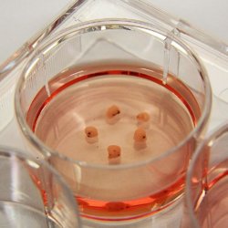 ST CTBRAINS