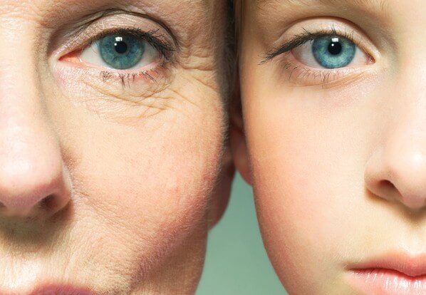 age