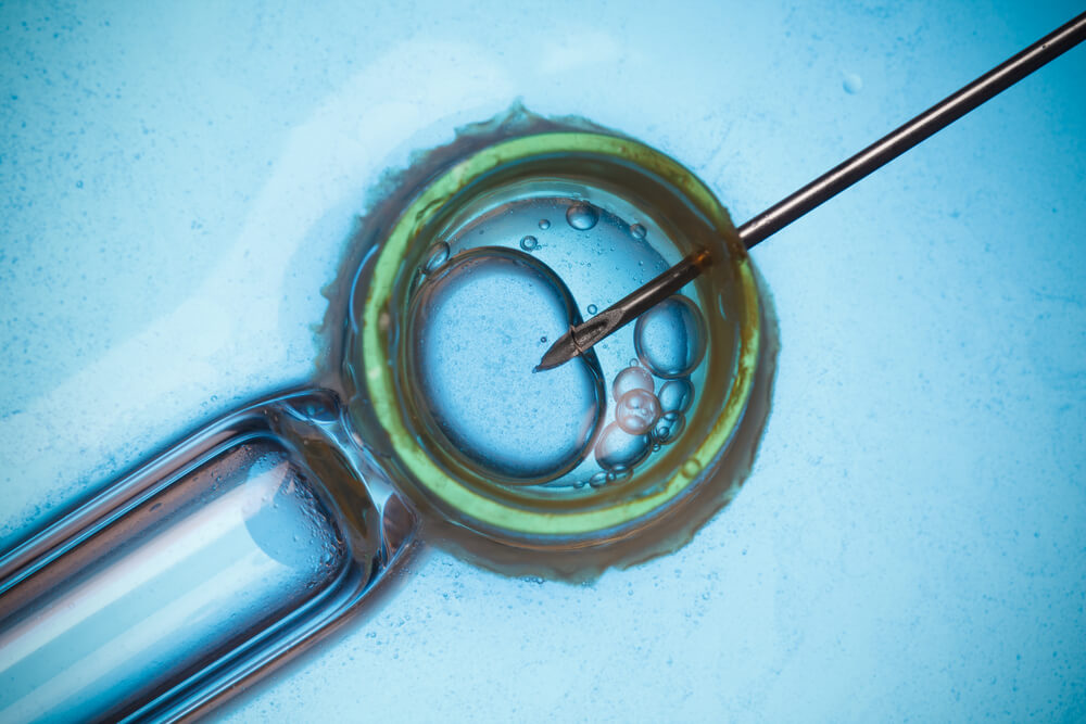 ivf