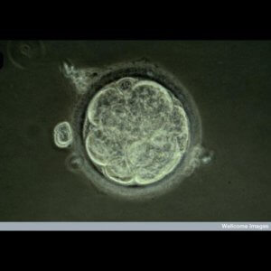 blastocyst