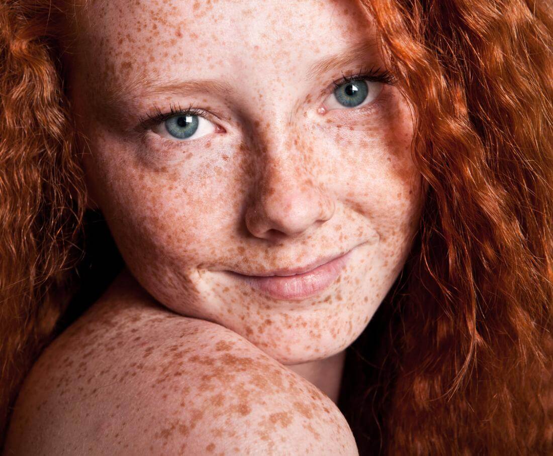 Are we in danger of losing blue-eyed redheads? Not likely - Genetic  Literacy Project