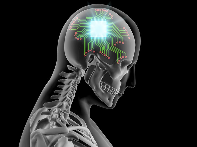 neuralink and the brains magical future wait but why