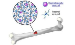 Bone marrow stem cell x