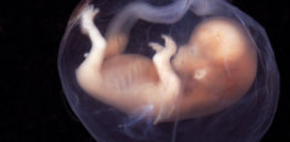 Reproductive medicine could become entangled in the 'embryos are people' debate