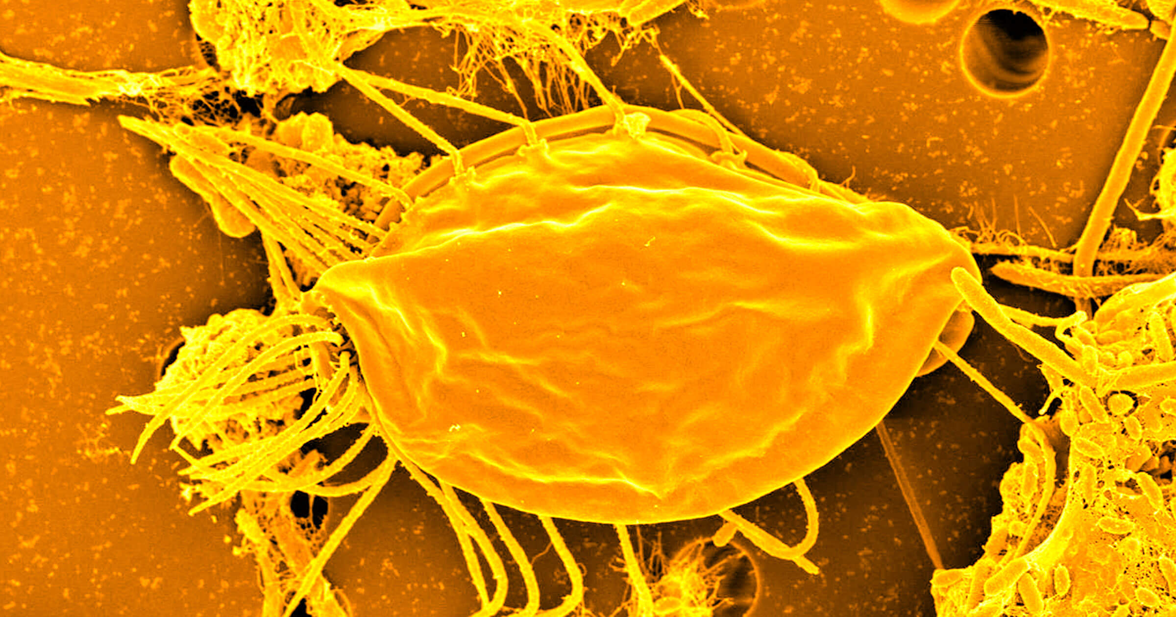 tree life evolution hemimastigotes