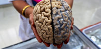 a formalin fixed human brain ready to be handed to visitors