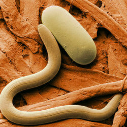 px soybean cyst nematode and egg sem