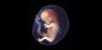 3-21-2019 week human embryo x