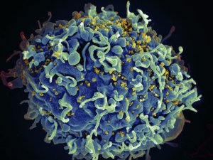 hiv on imm cell nih