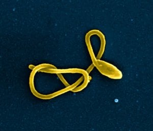 ebola virus particle