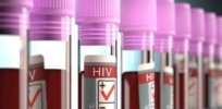 hiv positive blood vials large
