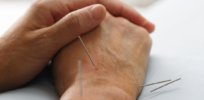 acupuncture on wrist