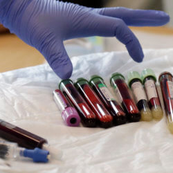 car t immunotherapy blood samples