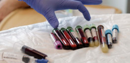 car t immunotherapy blood samples