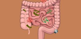 why the gut microbiome is crucial for your health x thumbnail