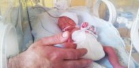 x preemie baby in incubator