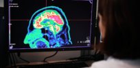 scientists can see suicide risks brain imaging