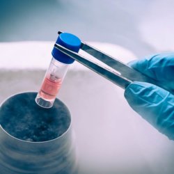 stem cell therapy in neurodegenerative diseases