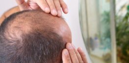 balding cutting edge treatment could be the end of baldness docent ft x