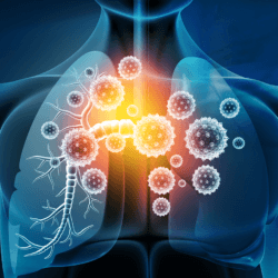 covid coronavirus lungs