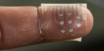 Help for future burn victims? Electronic ‘replacement skin’ can feel touch and temperature
