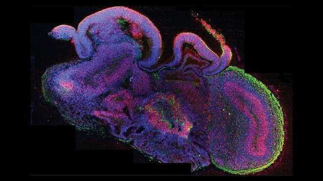 lab grown brain organoids mature like infant brains