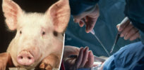 Podcast: Pig and cow organs for human transplant? From valves to tendons, xenotransplanted animal parts are common, but so is rejection due to alpha gal meat allergies. Gene-altered pigs could change that