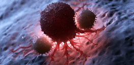 Subtle shift in the causes and treatment of cancer in the US underway