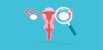 200,000-women study concludes that ovarian cancer screening with ultrasounds or blood tests does not reduce early deaths