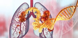 For decades, scientists struggled to find a treatment for one of the most common lung cancer mutations. Amgen has won US approval for the first drug targeting the KRAS variant