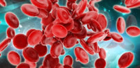 Why sickle cell disease is a perfect target candidate for CRISPR gene editing