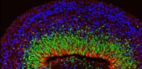 Stem cells harvested from patient with neurological disorder turned into 3D mini brain that shows signs of seizures
