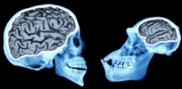Why is the human brain so different from the brains of closely-related species?
