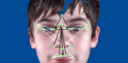 3D scans of 5,000 points on the human face show links to genetic factors related to autism