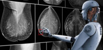 Novel artificial intelligence (AI) as good as physicians at reading ultrasound images and detecting breast cancer