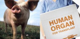 First pig-grown kidney transplant successfully trialed in humans