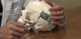 Brain pacemaker? Deep stimulation therapy shown shows promise in relieving severe depression