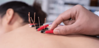 How did this acupuncture study get published in Nature?