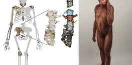 Evidence emerges that this early human species swung from trees but also walked upright
