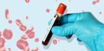 Can blood work provide a road map for beauty treatments and lifestyle choices?