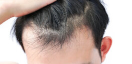 Going bald? Scientists have reprogrammed cells to grow hair on mice. Are humans next?
