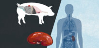 Viewpoint: Will successful GMO pig heart and kidney transplants challenge anti-biotechnology mindsets?