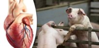 GMO heart transplant: In breakthrough, man with terminal disease receives heart from altered pig and is in recovery