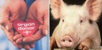 Transplant of genetic modified pig heart into a human sparks ethical debate