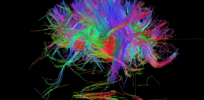 Maps of the neural ‘wiring’ in our brains could unravel secrets of behavior