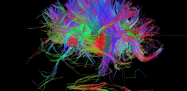 Maps of the neural ‘wiring’ in our brains could unravel secrets of behavior