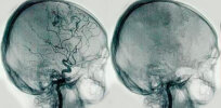 What happens in our brains when we die?