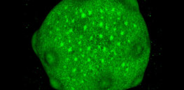 What are the genetic causes of autism? The brain is difficult to study but gene-edited organoids open avenues for research
