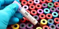 Solving the mystery of Epstein-Barr: Virus found in 95% of people leads to hundreds of thousands of cancers a year. Can we develop a vaccine?